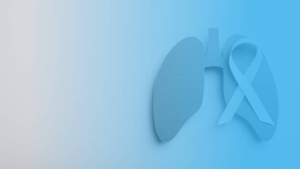 Lung Cancer Charities Dedicated to Research and Progress